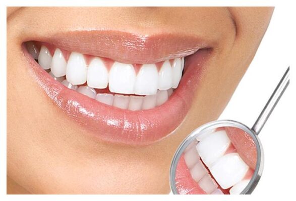 лучшее приложение для отбеливания зубов