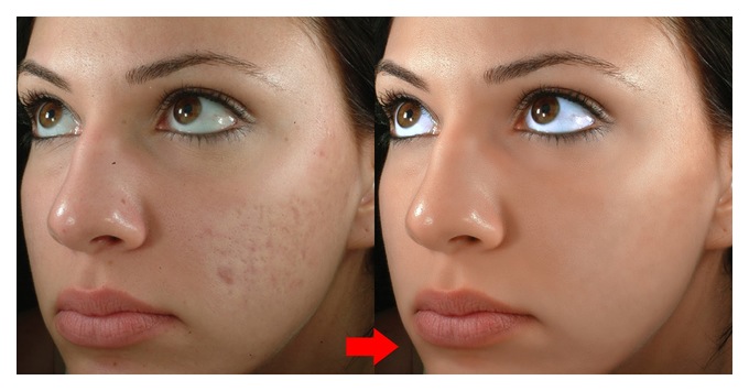 приложение retouch me отзывы